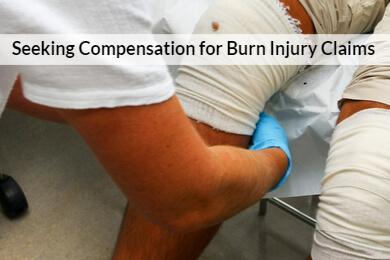 Burn Injury lawyer Chicago